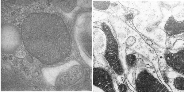 新突破广州生物岛实验室与中科院生物物理所合作成功研制针对病理组 生物通