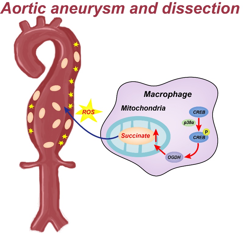 郑乐民团队发现主动脉瘤和主动脉夹层的新标志物和治疗靶点