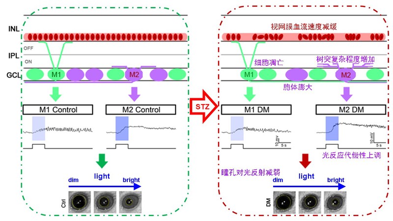 杨雄里、钟咏梅、翁史钧科研团队报道糖网病小鼠自感光视网膜神经节细胞的亚型特异性重塑及...