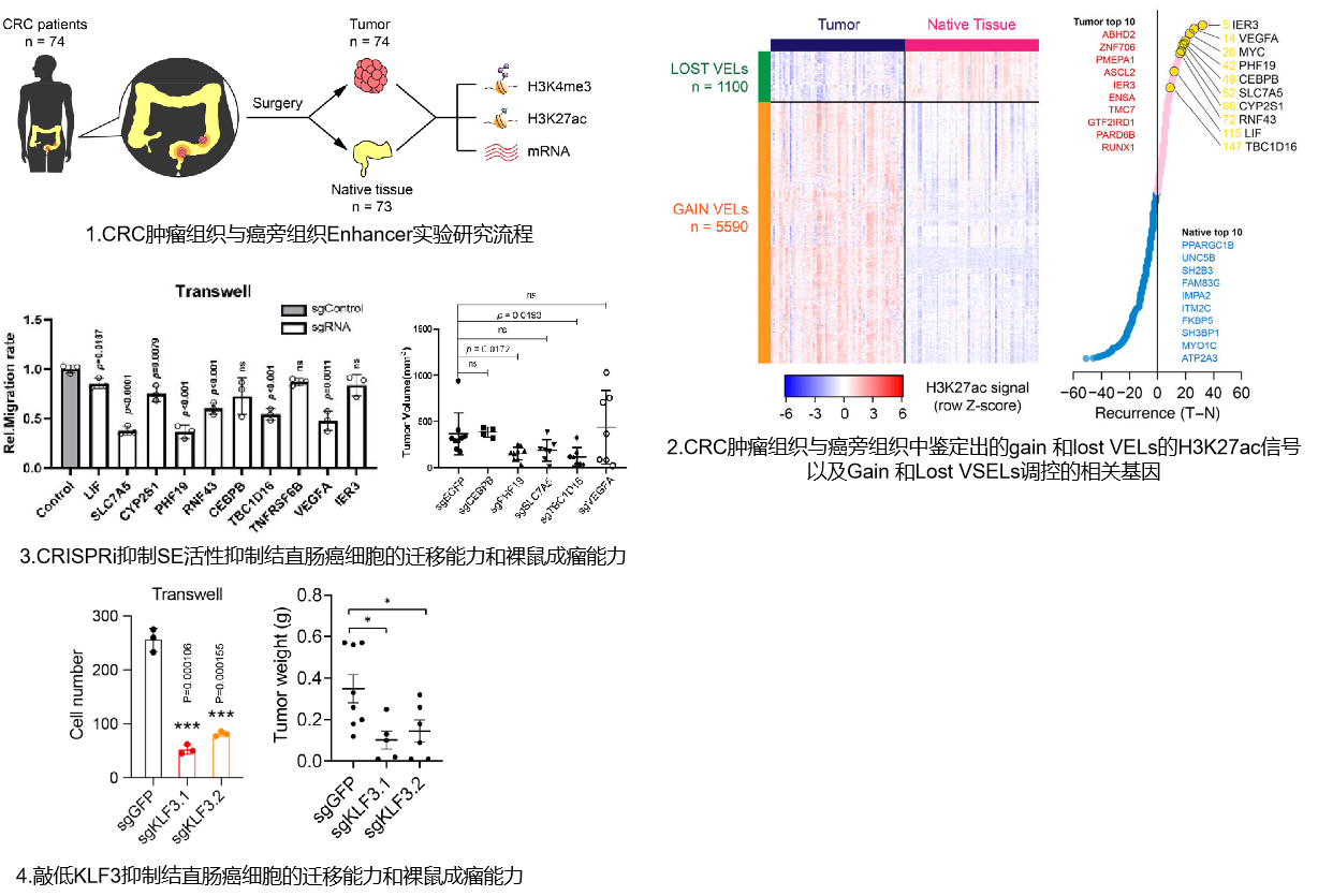 吴旻课题组关于结直肠癌的致癌转录因子研究取得新进展