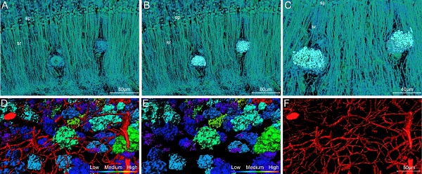 Front. Neurosci.︱阿尔茨海默症模型小鼠全脑Aβ斑块及其周围多种结构的高精度全景图