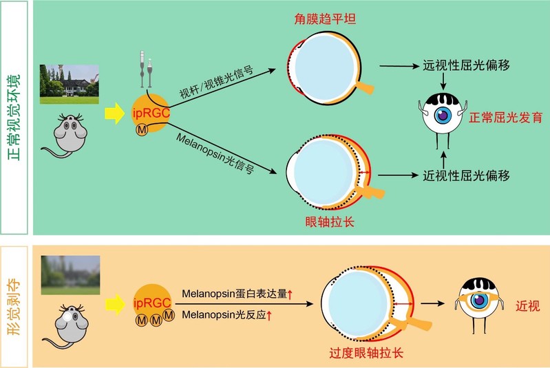 杨雄里院士团队揭示自感光视网膜神经节细胞在近视形成中的重要作用